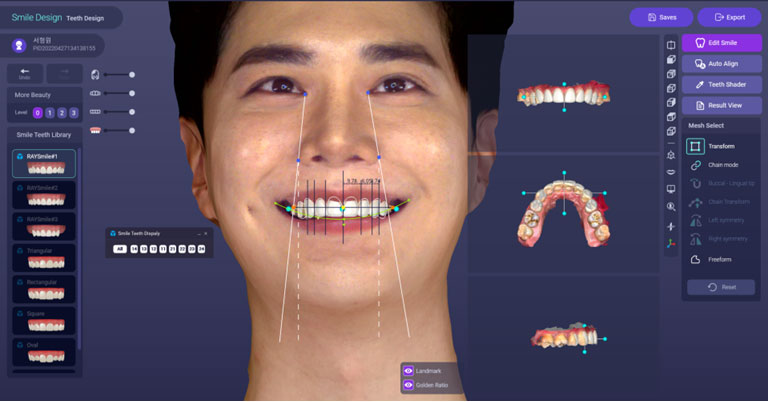 デジタルスキャナ