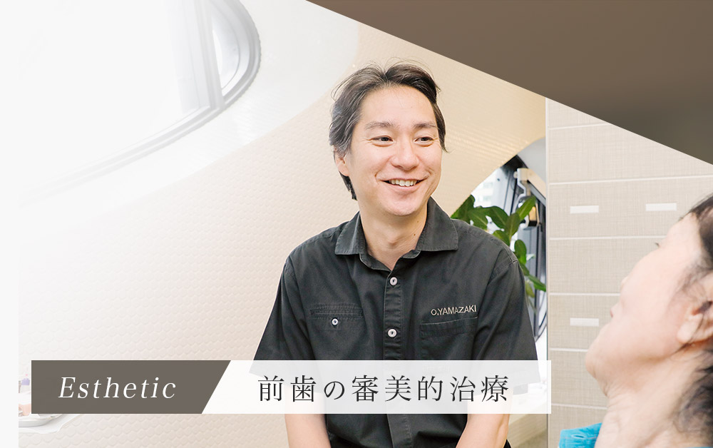 前歯の審美的治療